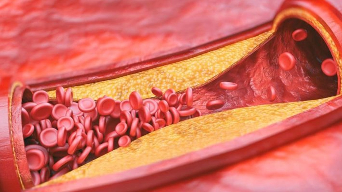 Холестерин під контролем прості кроки до здорового серця