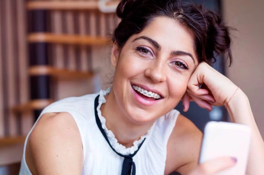 Догляд за брекетами: повний гайд для пацієнтів